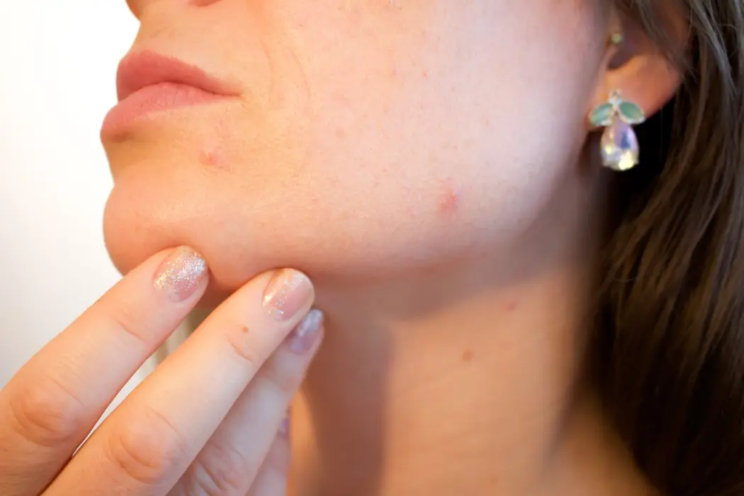 Problemy skórne jak dermatolog pomoże dzięki e-recepcie?
